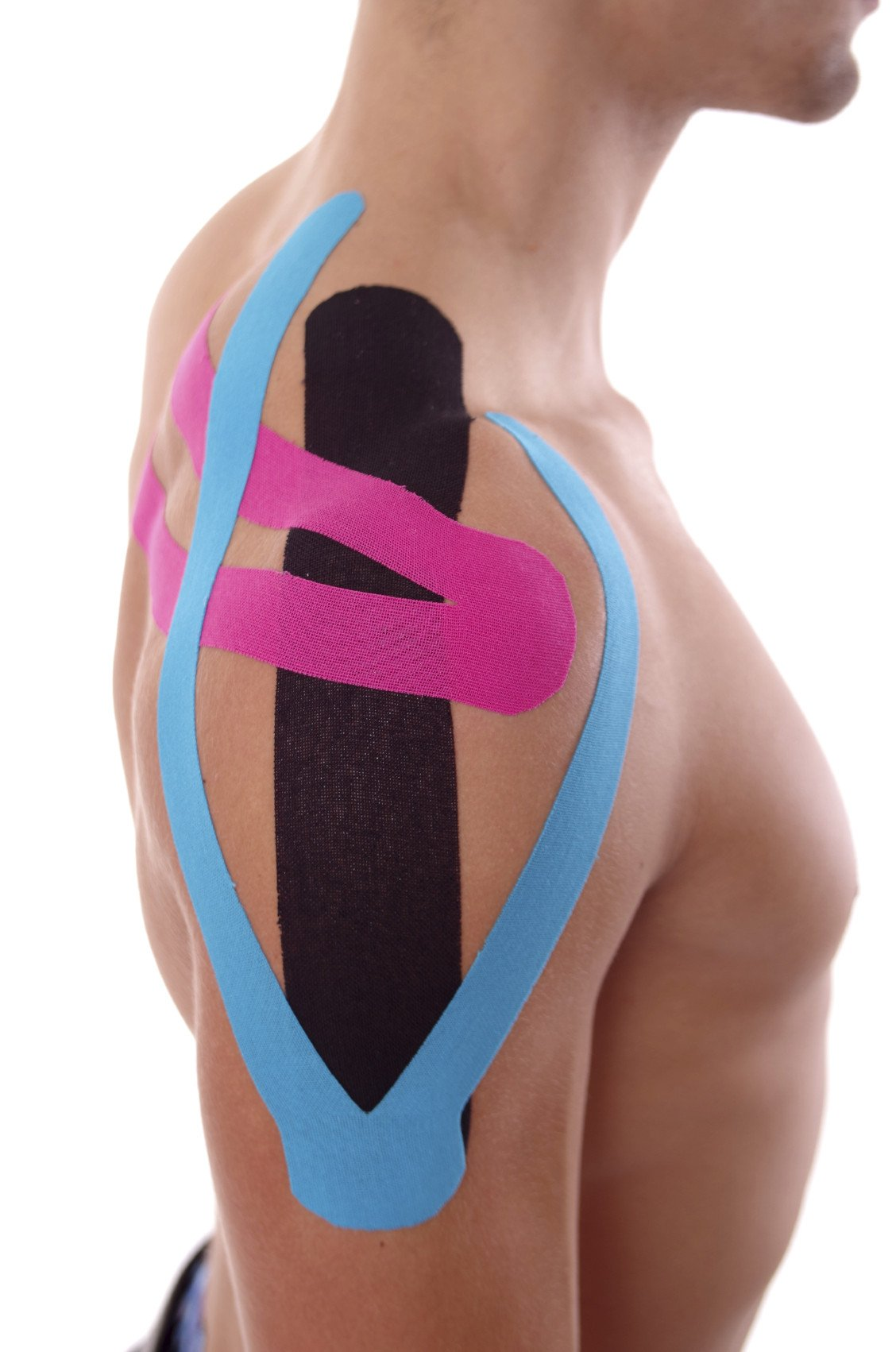Kinesiology tape applied to the shoulder and upper back for muscle support and pain relief.